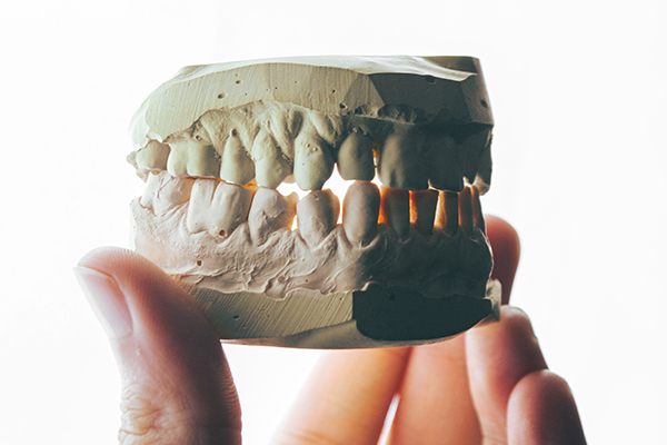 WT 331 | Dental Problems