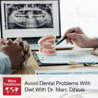 Avoid Dental Problems With Diet
