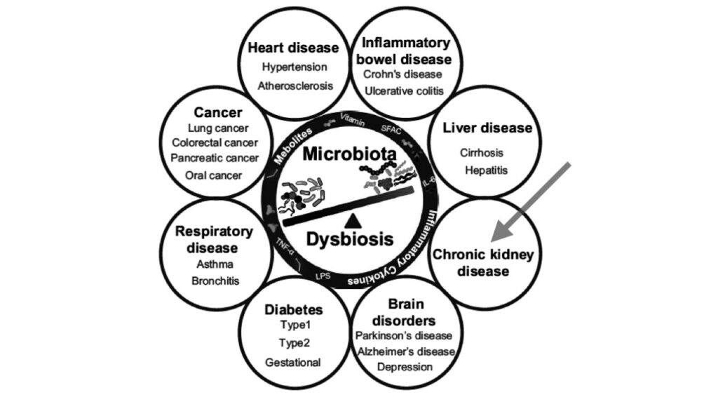 gut health diagram