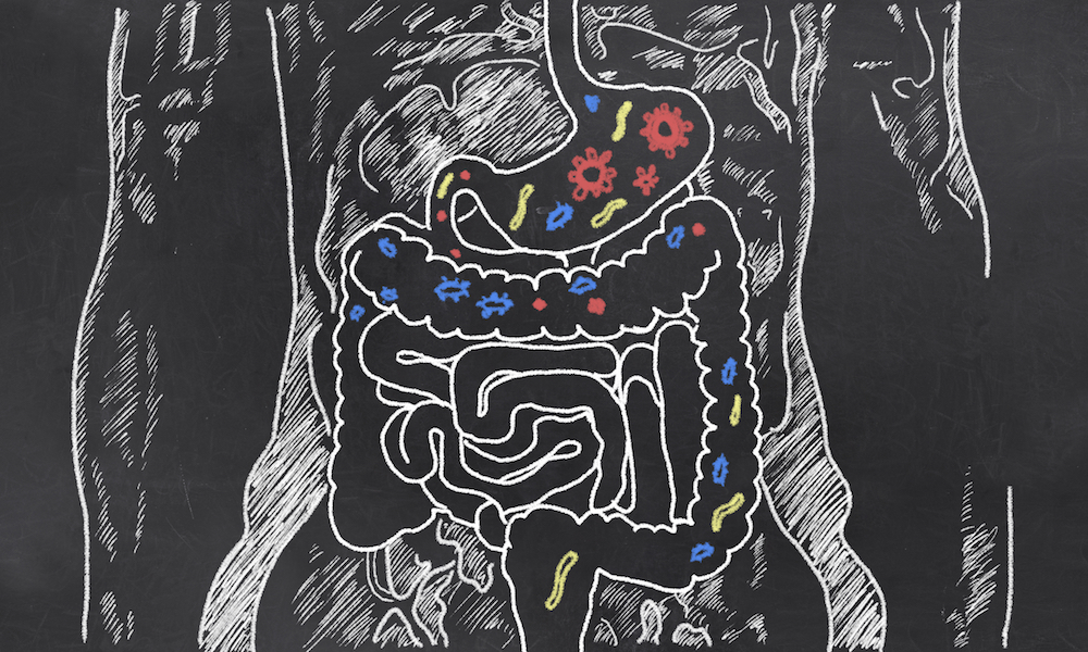 Leaky Gut, Autoimmunity And Chronic Disease