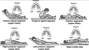 illustration of body positions that help to heal lungs after covid