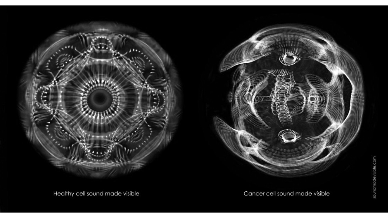 Cymascopic images of the “song” of a healthy cell and of a cancer cell, from Raman-derived sound files, courtesy of Dr. Ryan Stables, Birmingham University, UK