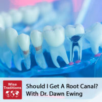 Should I Get A Root Canal?