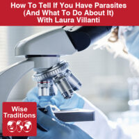 How To Tell If You Have Parasites (And What To Do About It)