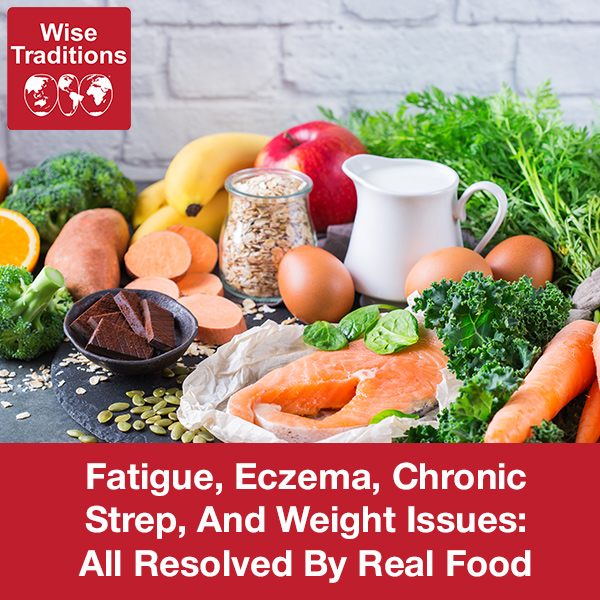 Fatigue, Eczema, Chronic Strep, and Weight Issues: All Resolved by Real Food