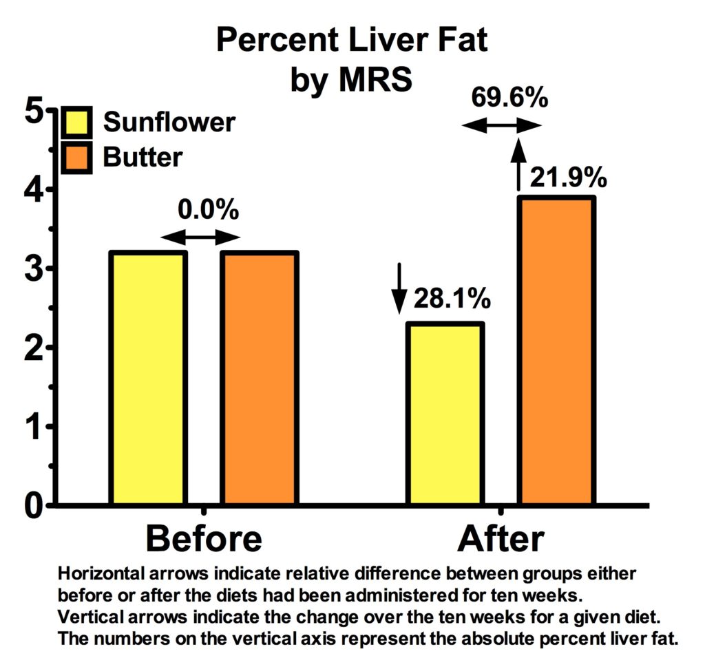 Liver-Fat-MRS