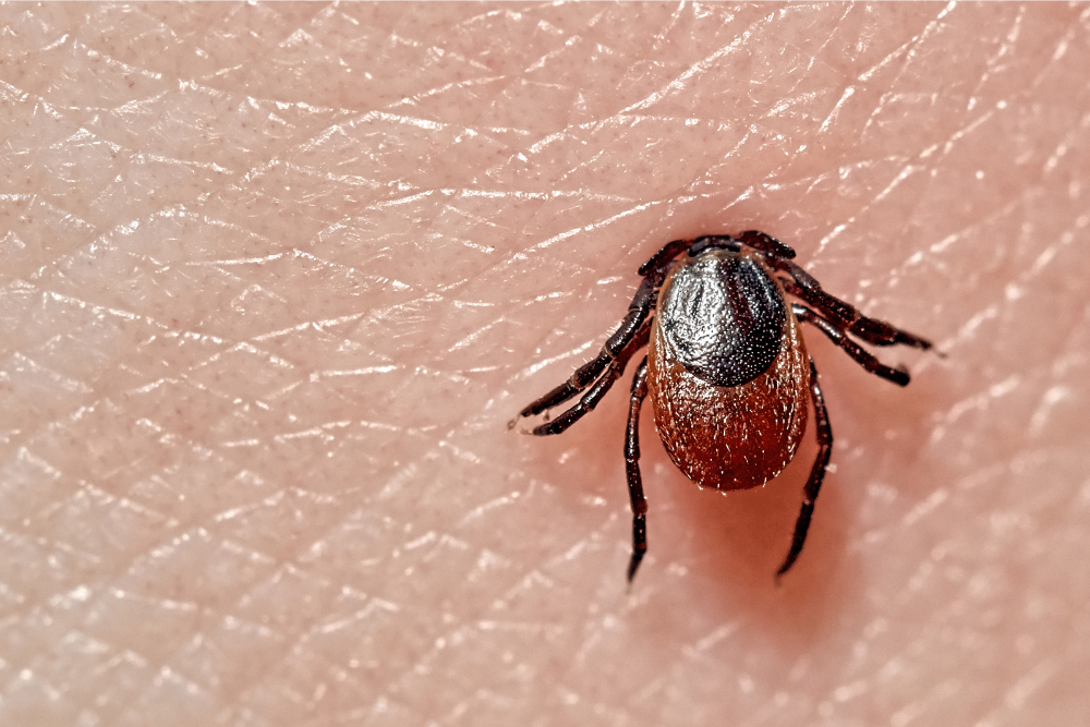 Are Explanations for Lyme Disease Another House of Cards?
