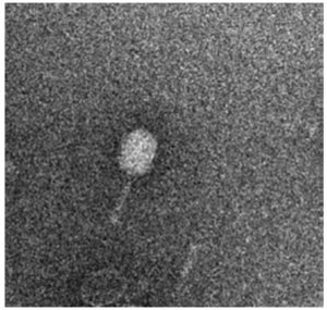 Isolated, purified bacteriophages seen under a microscope