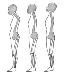 Alexander Techniques For Better Posture - Weston A. Price Foundation