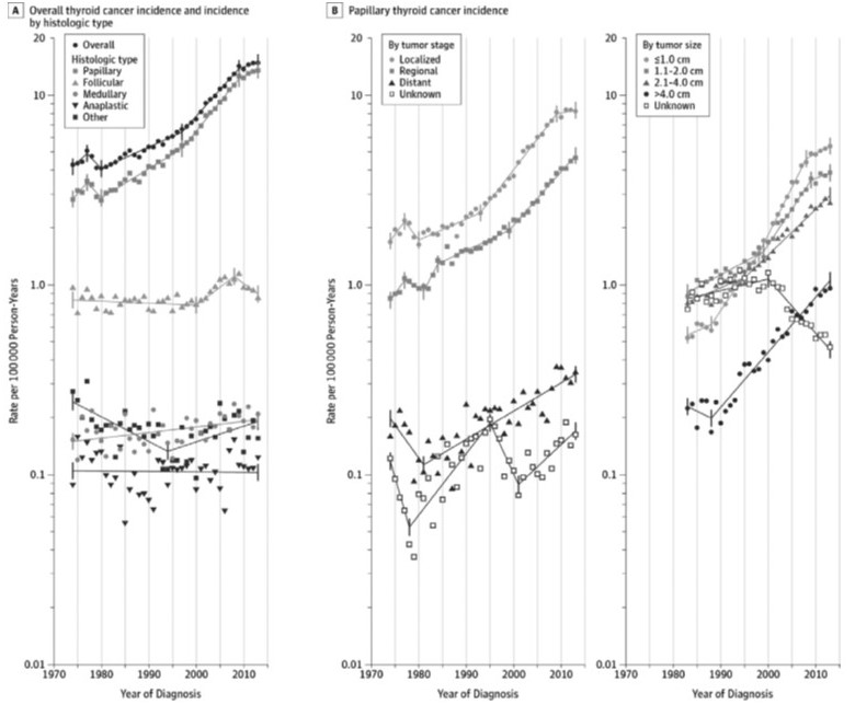 Radiofrequency Radiation: A Significant Factor in Increasing Thyroid Cancer?