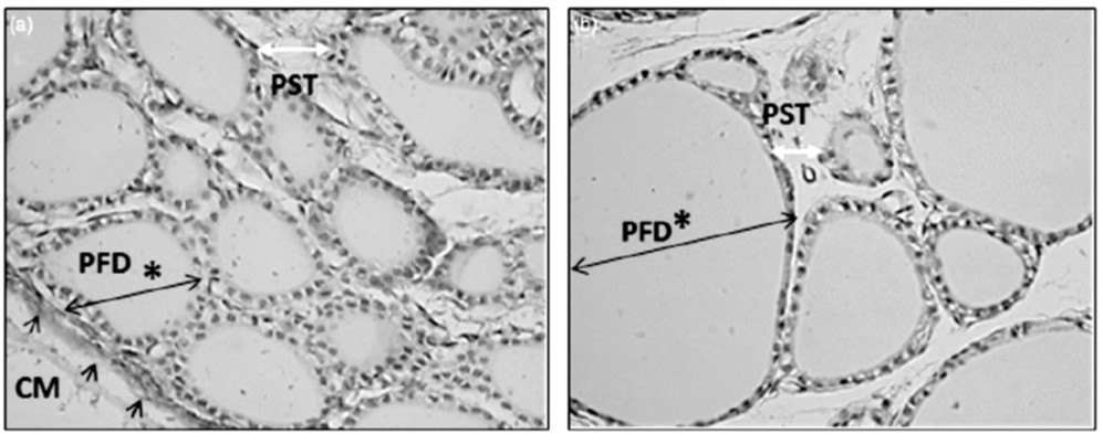 microscopic image shows the thyroid tissue of exposed rats compared to the thyroid tissue in the control group