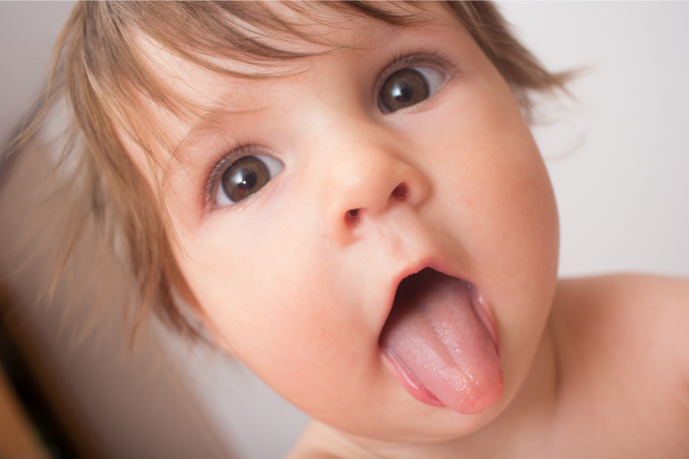 Baby Tongue-Tie: Eliciting Controversy for Two Thousand Years
