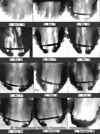 fall09-figure7-expansionrod-a