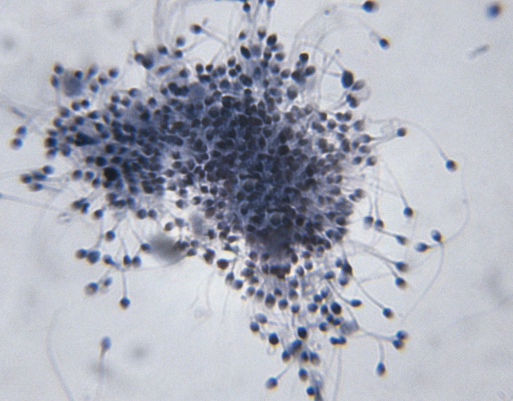 Restoring Male Fertility